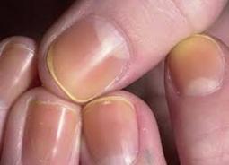 Почему гель лак тускнеет на ногтях и как сохранить свежесть маникюра?