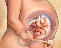 Беременность 33 недели что чувствует ребенок